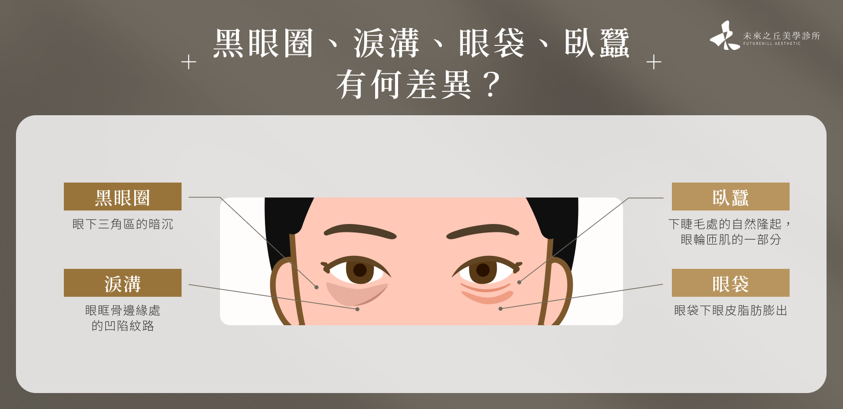 黑眼圈、淚溝、眼袋、臥蠶有何差異?