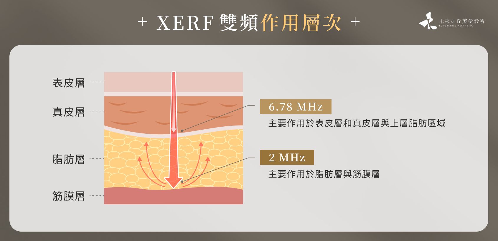 XERF雙頻作用層次